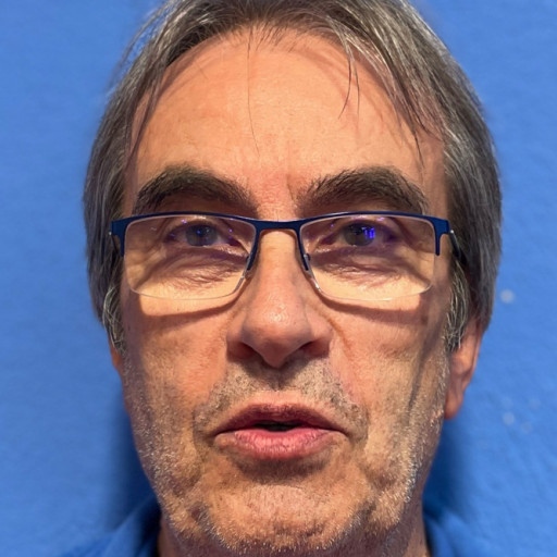 Claude Chantepie